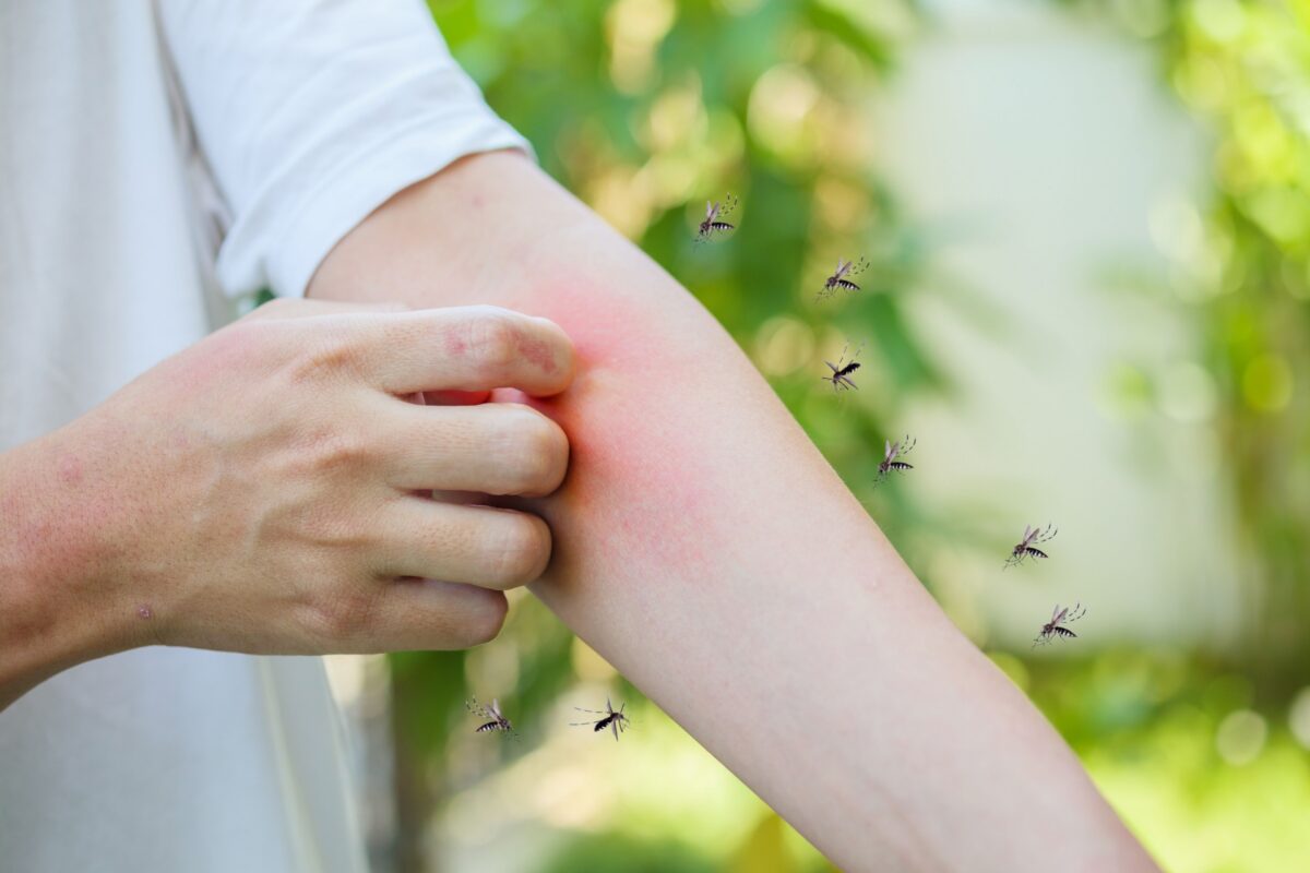 Best Ways to Reduce Mosquitoes in Your Orlando Yard